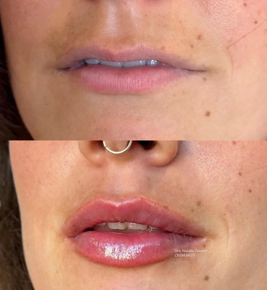 Publicação original da Natália com o antes e o depois